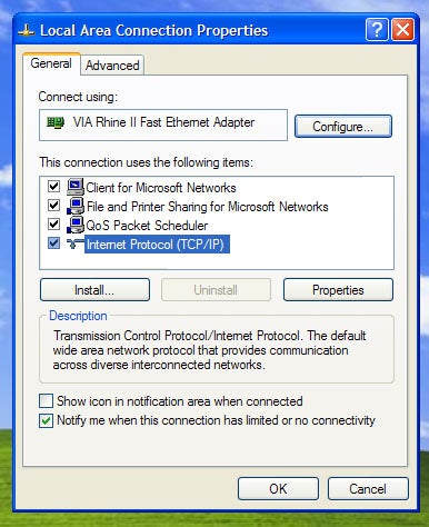 Connect Vista Xp Network Cable