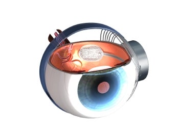 Argus Eye